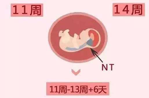 怀孕12周nt值1.2mm是男还是女(nt值1.2mm正常吗)