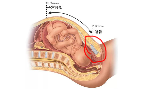 孕妇耻骨位置图在哪个地方(孕妇耻骨疼痛怎么办)