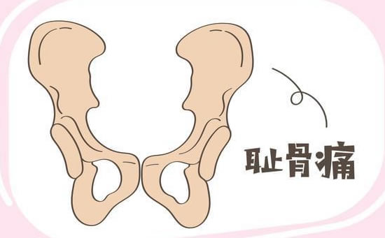 孕妇耻骨位置图在哪个地方(孕妇耻骨疼痛怎么办)