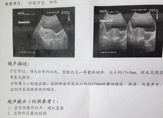 17周男孩和女孩b超的区别(男孩女孩b超有哪些区别图)