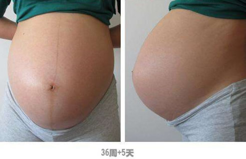 已经生了男孩孕晚期肚型图片(生男孩肚子有哪些特征)