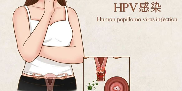 hpv疫苗可以用医保吗(HPV疫苗有哪些)