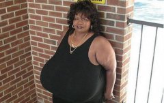 世界上最大胸重排行,安妮·霍金斯特纳胸部重达77斤