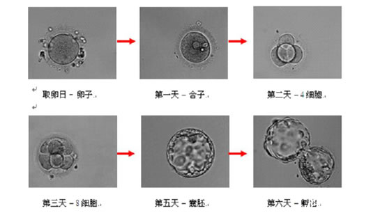3BB和4BB囊胚区别(3bb和4bb囊胚性别一样吗)