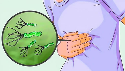 备孕和幽门螺杆菌什么关系(备孕要查幽门螺旋杆菌吗)