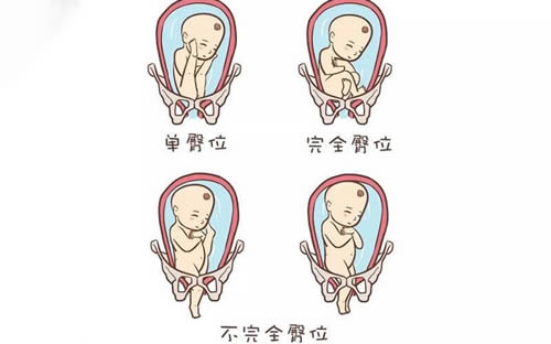 孕晚期胎儿位置图图片