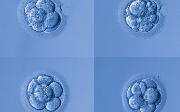 胚胎移植具体过程图解(胚胎移植后有哪些注意事项)