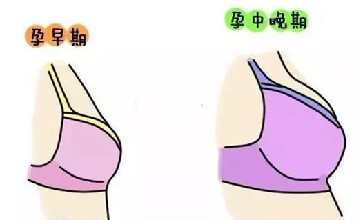 刚怀孕乳房症状变化(怀孕后乳房疼痛什么原因)