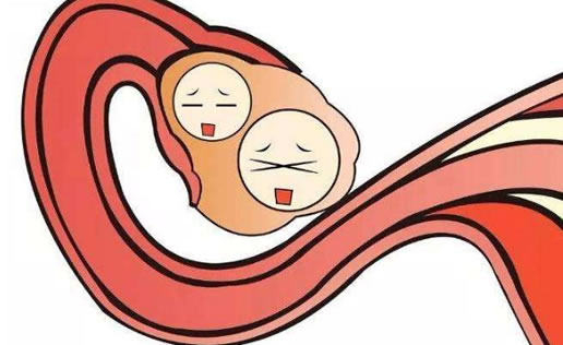 备孕女性有必要测卵泡吗(哪些人需要监测排卵)