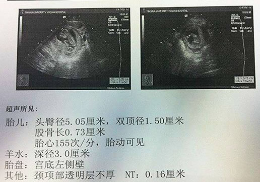 简单2个自测男女方法(孕期nt单子上暗示男女自测法)