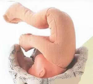 宝宝入盆后的肚型图片(入盆过程图及症状)
