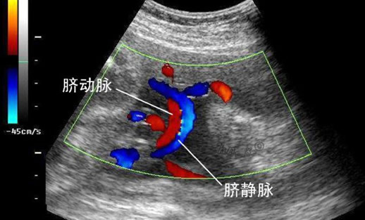 脐动脉两条是不是男孩(民间看男孩方法)