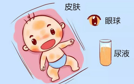 新生儿1到30天黄疸值对照表(新生儿黄疸该怎么应对)