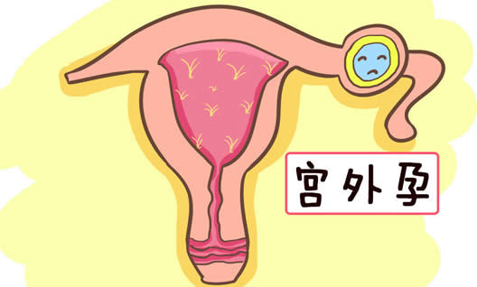 如何确诊宫外怀孕方法(宫外孕早期七个征兆汇总)