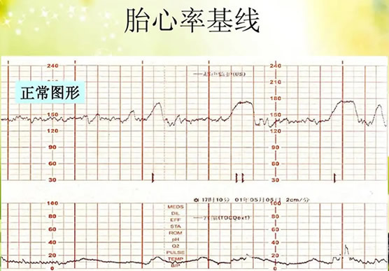 男女胎心率对照表(可以准确看出男女)