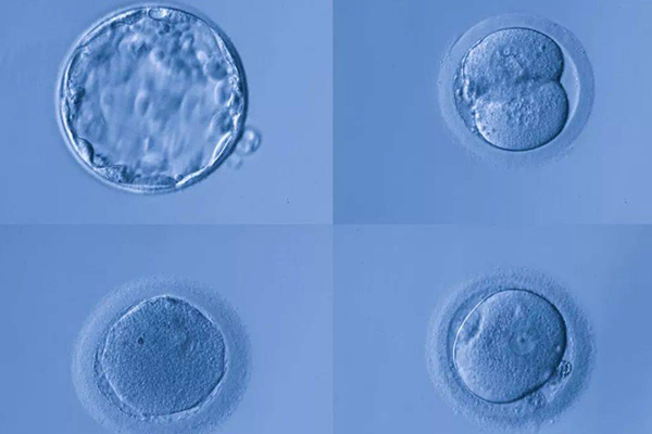 早囊和囊胚的区别(成功率是否一样)