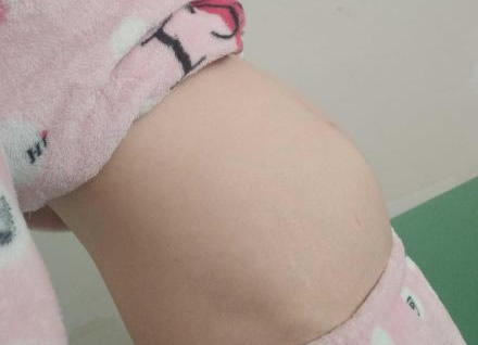 孕期男孩和女孩鼓包区别图 真实图片可以来看一看