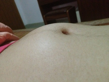 孕期男孩和女孩鼓包区别图 真实图片可以来看一看