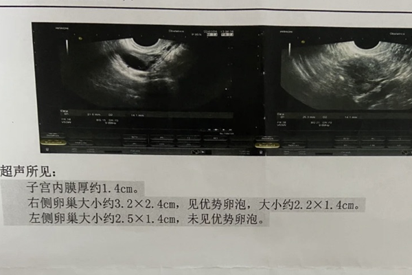内膜1.4cm厚是否有可能是怀孕？