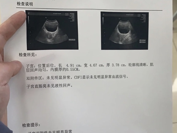 内膜17mm回声不均匀是啥意思？