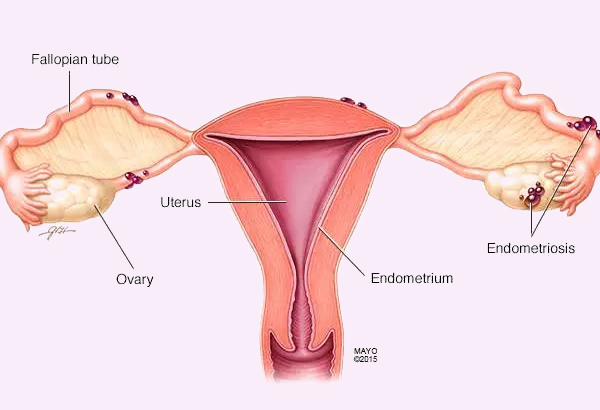 子宫内膜2.8mm能不能怀孕？