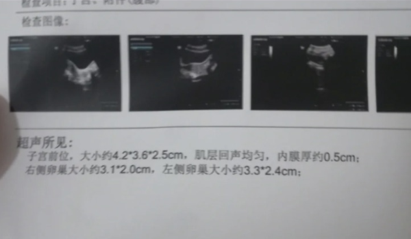 子宫内膜5mm吃什么可以增厚？