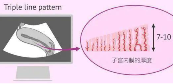 内膜厚4.3mm回声不均是什么意思？