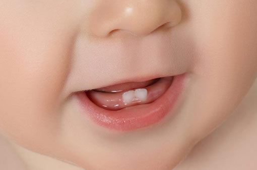 婴儿几岁开始长牙 宝宝出牙时间图参考