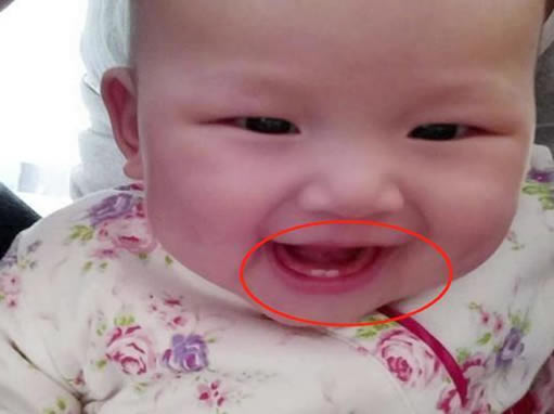 婴儿几岁开始长牙 宝宝出牙时间图参考