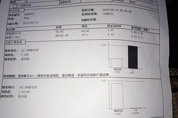 21三体临界是不是一般都没事(胎儿21三体临界风险)