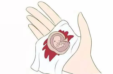 生化妊娠的10个征兆(怀孕后生化妊娠流产是怎么造成的)