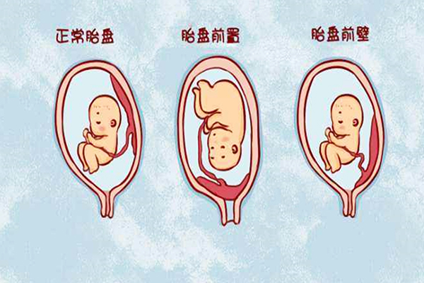 为什么胎盘前壁的孕妇少(怀孕胎盘前壁是否有问题)