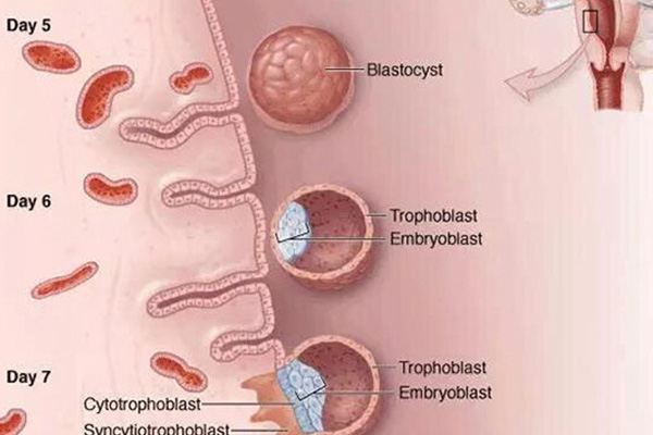 囊胚着床详细过程(冻囊胚放进去是不是就着床了)