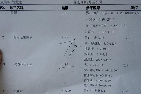 fsh值与年龄对照表(促卵泡生成素fsh大于8是不是卵巢衰退)