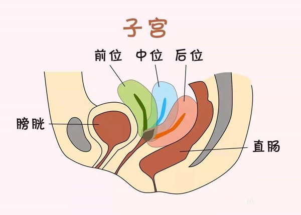 子宫前位和子宫后位图片区别(哪个比较容易受孕)