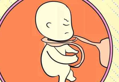 如何判断胎宝宝是否脐带绕颈(附3个方法)