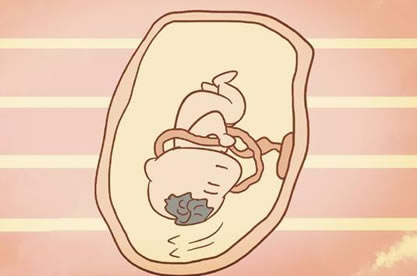 孕37周系带绕脖两周注意什么 脐带绕颈两周是胎儿调皮好动吗