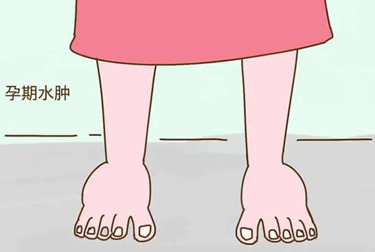 孕期手脚浮肿是什么原因引起的(缓解孕期水肿的10个方法)