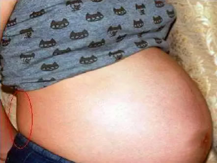 孕期肚型可以看男女吗 2023怀孕孕肚看男女参考方法图解