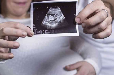 孕期为什么有的nt值特别小 怀孕初期nt检查最佳时间