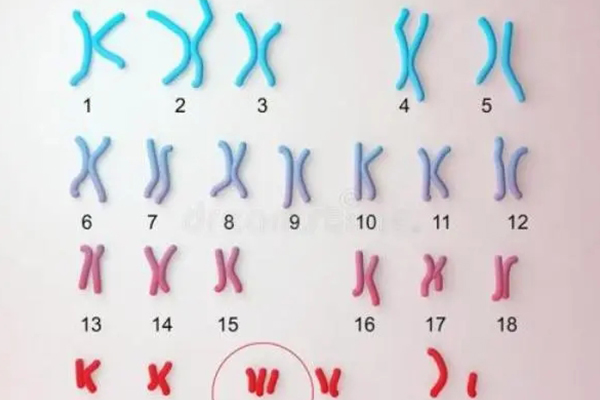胎儿1号染色体重复的后果 1号染色体微重复的人多不多