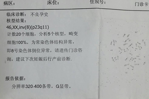 2号染色体异常是遗传谁 染色体2号缺失是不是遗传父亲