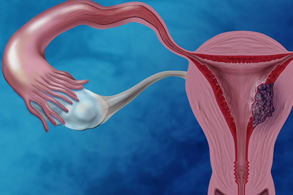 子宫内膜厚度变化图表 月经前后子宫内膜厚度变化