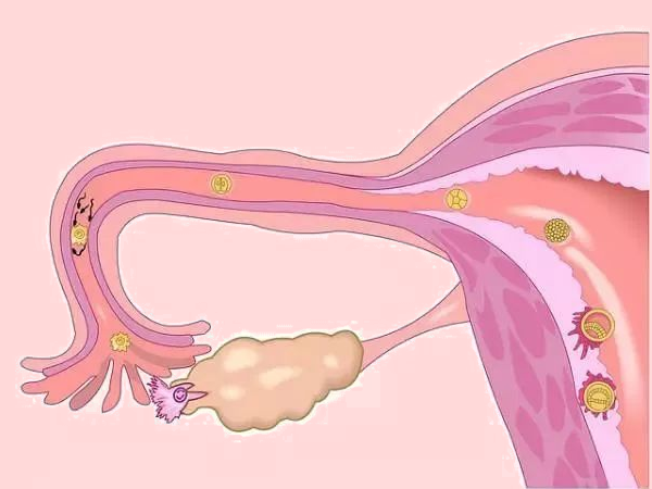 卵泡长不到18就排了怎么办(附卵泡发育不好怎么调理好)