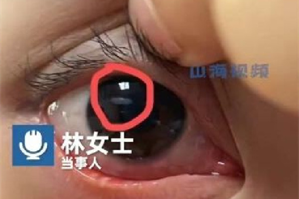 女生用发卡烫睫毛眼球烫个泡 烫睫毛和接睫毛哪个好