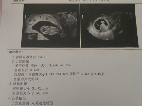 孕囊胎芽大小与孕周对照表怎么看(附正常长度比例计算公式)