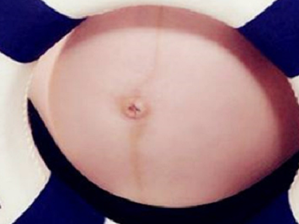二胎怀孕肚子上没有一条很长很粗的黑线是男孩还是女孩？