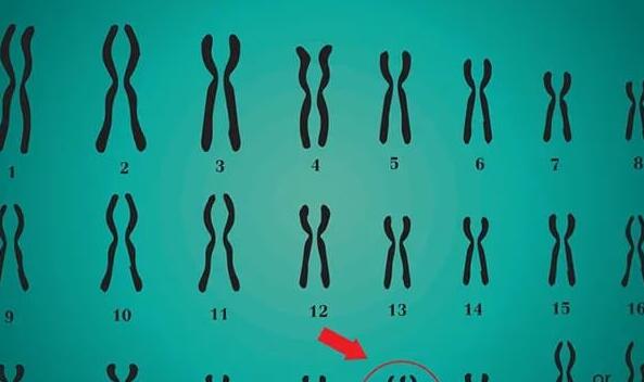 男性21号染色体异常的原因(男性染色体21PSS能否要小孩)