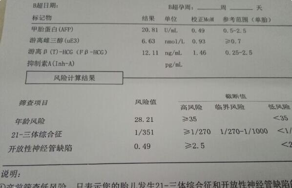 21号染色体多了一条是什么病(附原因)