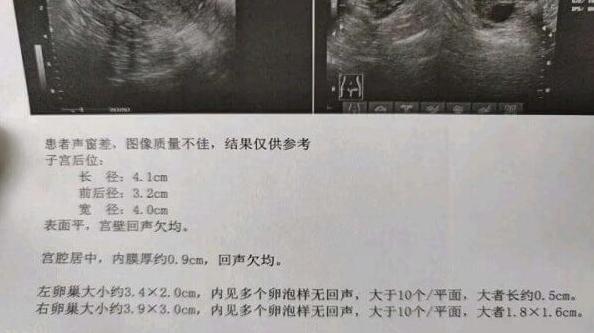 卵泡不破的原因及症状有哪些(用什么方法能让卵泡破裂)